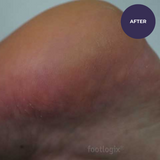 Footlogix DD Cream Mousse Formula 125ml