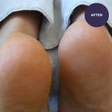 Footlogix Very Dry Skin Formula 125ml