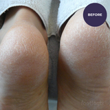 Footlogix Very Dry Skin Formula 125ml